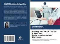 Produktbild: Beitrag der PET-CT zu 18 F FDG bei bronchopulmonalem Karzinom