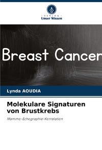 Produktbild: Molekulare Signaturen von Brustkrebs