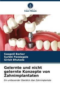 Produktbild: Gelernte und nicht gelernte Konzepte von Zahnimplantaten