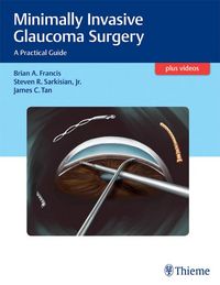 Produktbild: Minimally Invasive Glaucoma Surgery