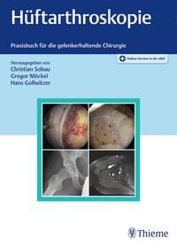 Produktbild: H&uuml;ftarthroskopie