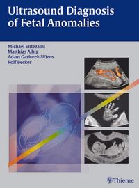 Produktbild: Ultrasound Diagnosis of Fetal Anomalies