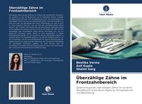 Produktbild: &Uuml;berz&auml;hlige Z&auml;hne im Frontzahnbereich