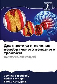 Produktbild: Diagnostika i lechenie cerebral'nogo wenoznogo tromboza