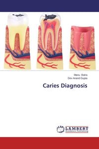 Produktbild: Caries Diagnosis