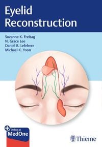 Produktbild: Eyelid Reconstruction