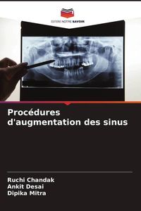Produktbild: Proc&eacute;dures d'augmentation des sinus
