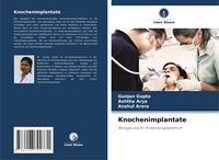 Produktbild: Knochenimplantate