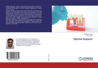 Produktbild: Dental Implant