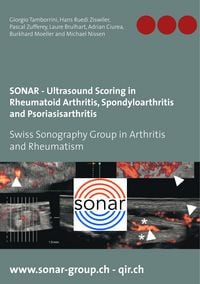 Produktbild: SONAR - Ultrasound Scoring in Rheumatoid Arthritis, Spondyloarthritis and Psoriasisarthritis