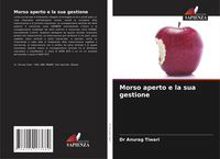 Produktbild: Morso aperto e la sua gestione