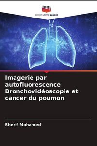 Produktbild: Imagerie par autofluorescence Bronchovid&eacute;oscopie et cancer du poumon