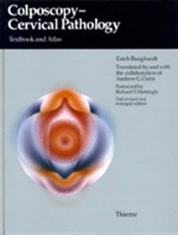 Produktbild: Colposcopy, Cervical Pathology
