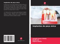 Produktbild: Implantes de pe&ccedil;a &uacute;nica