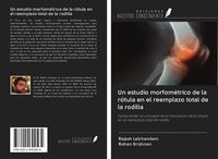 Produktbild: Un estudio morfom&eacute;trico de la r&oacute;tula en el reemplazo total de la rodilla