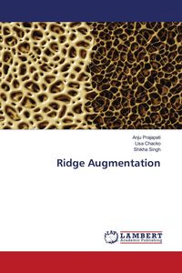 Produktbild: Ridge Augmentation