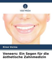 Produktbild: Veneers: Ein Segen f&uuml;r die &auml;sthetische Zahnmedizin
