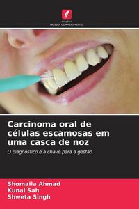 Produktbild: Carcinoma oral de c&eacute;lulas escamosas em uma casca de noz
