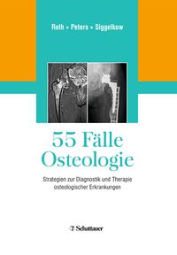 Produktbild: 55 F&auml;lle Osteologie