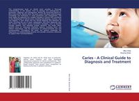 Produktbild: Caries - A Clinical Guide to Diagnosis and Treatment