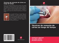 Produktbild: T&eacute;cnicas de remo&ccedil;&atilde;o de c&aacute;ries ao longo do tempo