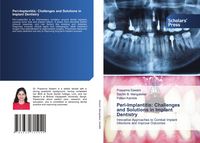 Produktbild: Peri-Implantitis: Challenges and Solutions in Implant Dentistry