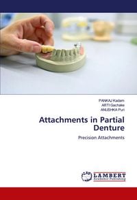 Produktbild: Attachments in Partial Denture
