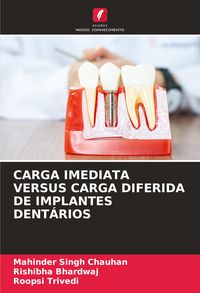 Produktbild: Carga Imediata Versus Carga Diferida De Implantes Dent&aacute;rios