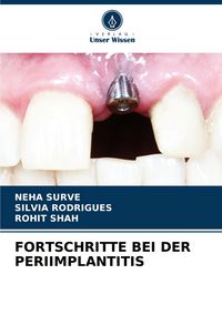 Produktbild: Fortschritte bei der Periimplantitis