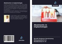 Produktbild: Abutments in implantologie