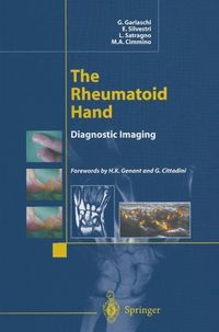 Produktbild: The Rheumatoid Hand