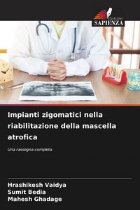 Produktbild: Impianti zigomatici nella riabilitazione della mascella atrofica