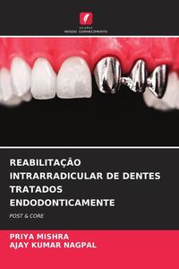 Produktbild: Reabilita&ccedil;&atilde;o Intrarradicular De Dentes Tratados Endodonticamente
