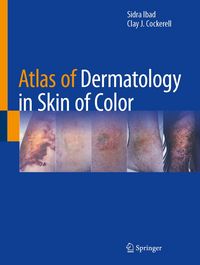 Produktbild: Atlas of Dermatology in Skin of Color