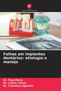 Produktbild: Falhas em implantes dent&aacute;rios: etiologia e manejo