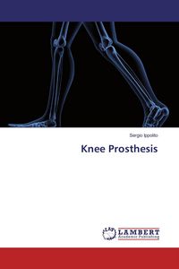 Produktbild: Knee Prosthesis