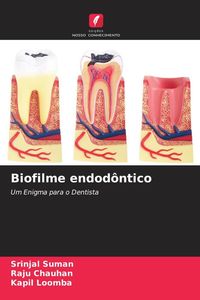 Produktbild: Biofilme endod&ocirc;ntico