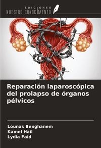 Produktbild: Reparaci&oacute;n laparosc&oacute;pica del prolapso de &oacute;rganos p&eacute;lvicos