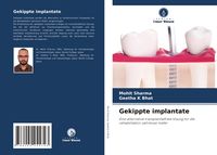 Produktbild: Gekippte implantate