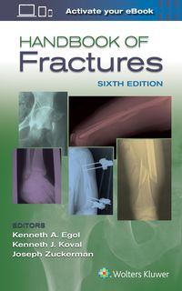 Produktbild: Handbook of Fractures