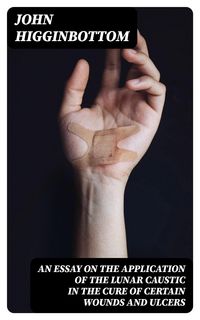 Produktbild: An Essay on the Application of the Lunar Caustic in the Cure of Certain Wounds and Ulcers