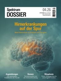 Produktbild: Spektrum Dossier 4/2026 Hirnerkrankungen auf der Spur