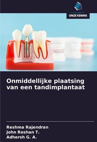 Produktbild: Onmiddellijke plaatsing van een tandimplantaat
