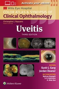 Produktbild: Uveitis