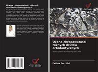 Produktbild: Ocena chropowato&iquest;ci r&oacute;&iquest;nych drut&oacute;w ortodontycznych