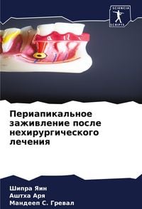 Produktbild: Periapikal'noe zazhiwlenie posle nehirurgicheskogo lecheniq