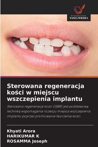 Produktbild: Sterowana regeneracja ko&iquest;ci w miejscu wszczepienia implantu