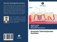 Produktbild: Enossale Zahnimplantat-Systeme