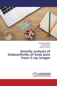 Produktbild: Severity analysis of Osteoarthritis of knee joint from X-ray images
