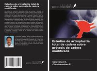 Produktbild: Estudios de artroplastia total de cadera sobre pr&oacute;tesis de cadera modificada